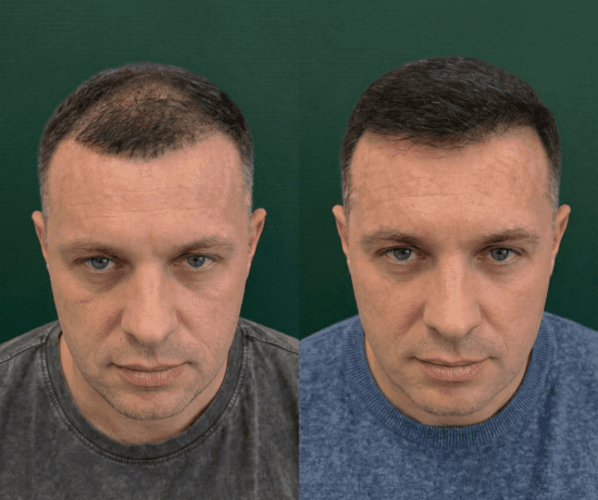 Денис, 33 года