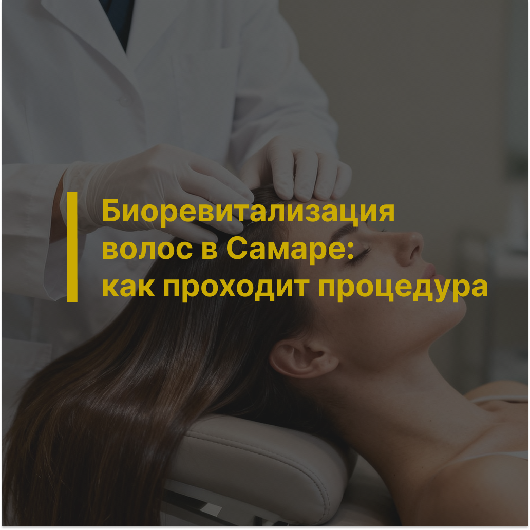 Биоревитализация волос в Самаре: как проходит процедура