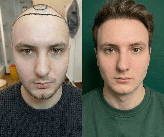 Кирилл, 35 лет